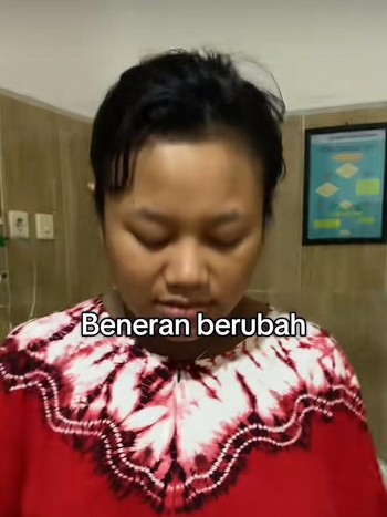 Viral Transformasi Drastis Wanita Usai Menikah, Fisik Berubah Bikin Trauma