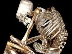 Misteri Kematian Mumi Berusia 1.100 Tahun Terpecahkan, Ini Penyebabnya