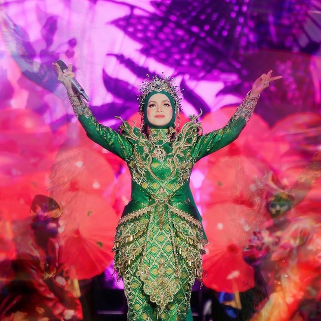 Siti Nurhaliza Kecelakaan, Alami Bengkak di Bagian Kaki