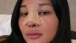 Mutia Ayu Operasi Hidung