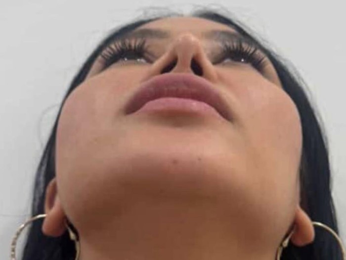 Mutia Ayu Operasi Hidung Keempat Kali, Ini Alasan Utamanya