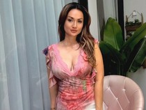 Tengku Dewi Update Hasil Oplas Saat Ultah ke-38