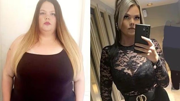 Wanita ini Sukses Diet dan Turun BB 82 Kg!