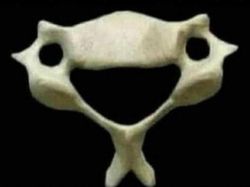 Foto Medis Ini Bikin Takjub Sekaligus Bikin Tak Nyaman