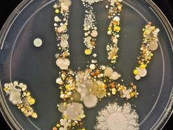 Foto Medis Ini Bikin Takjub Sekaligus Bikin Tak Nyaman