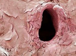 Foto Medis Ini Bikin Takjub Sekaligus Bikin Tak Nyaman