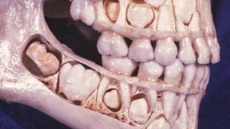 Foto Medis Ini Bikin Takjub Sekaligus Bikin Tak Nyaman