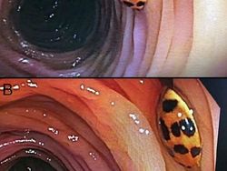 Foto Medis Ini Bikin Takjub Sekaligus Bikin Tak Nyaman