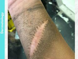 Foto Medis Ini Bikin Takjub Sekaligus Bikin Tak Nyaman