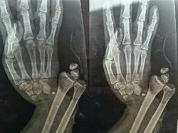 Foto Medis Ini Bikin Takjub Sekaligus Bikin Tak Nyaman