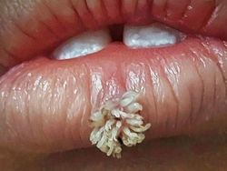 Foto Medis Ini Bikin Takjub Sekaligus Bikin Tak Nyaman