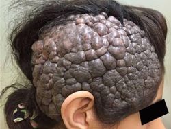 Foto Medis Ini Bikin Takjub Sekaligus Bikin Tak Nyaman