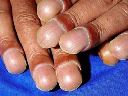 Foto Medis Ini Bikin Takjub Sekaligus Bikin Tak Nyaman