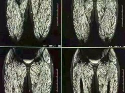 Foto Medis Ini Bikin Takjub Sekaligus Bikin Tak Nyaman