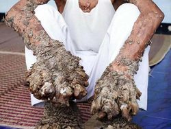 Foto Medis Ini Bikin Takjub Sekaligus Bikin Tak Nyaman