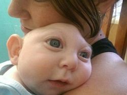 Foto Medis Ini Bikin Takjub Sekaligus Bikin Tak Nyaman