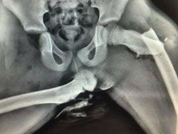 Foto Medis Ini Bikin Takjub Sekaligus Bikin Tak Nyaman