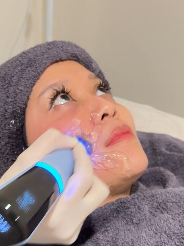 Perawatan Exion di Dermalogia Perawatan Exion di Dermalogia