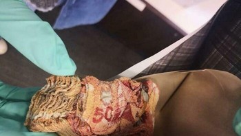 Ini CAD 5.000, bisa mengkerut karena seseorang pakai microwave untuk disinfeksi. Well... Foto: jdk via Bored Panda