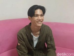 Pernah Viral Make Over, Eks Manusia Silver Kini Dilirik Agensi Model Korea
