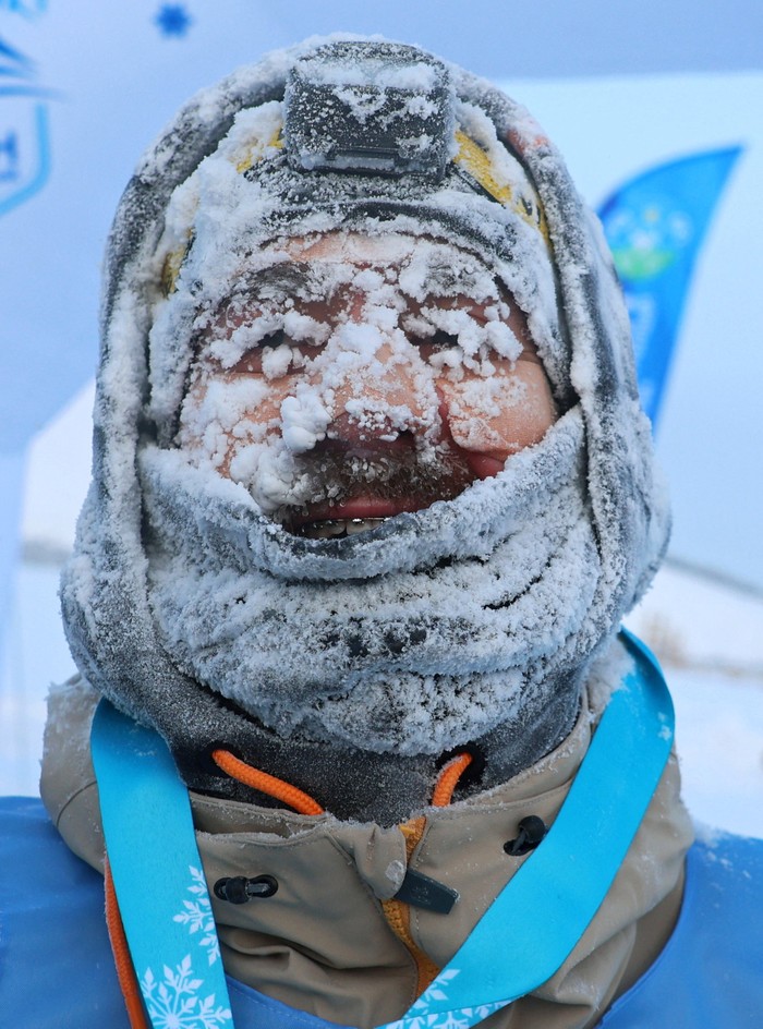 Ragam Potret Kondisi Wajah Atlet di Winter Marathon Yakutia