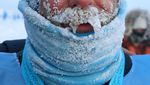 Ragam Potret Kondisi Wajah Atlet di Winter Marathon Yakutia