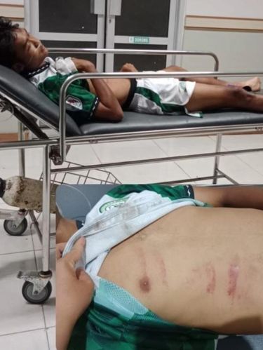 Tendangan Kungfu Tangkapan layar memperlihatkan tendangan kungfu dilakukan kiper PSIR Rembang ke arah pemain Persikaba Blora, Rizal Dimas, Rabu (21/1/2026).