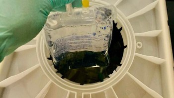 Pasien tidak datang untuk janji temu. Setelah dicampur, obat seharga USD 65 ribu atau kisaran Rp 1 miliar tersebut kedaluwarsa dalam waktu kurang dari 24 jam. Sayangnya, tidak ada pasien lain yang dijadwalkan untuk obat tersebut. Foto: Boredpanda