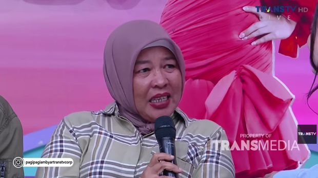 Kisah Mike yang dulu jadi manusia silver, kini menjadi model catwalk.