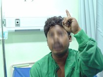 Cerita Pekerja PLTU Sukabangun: Bukan Terjatuh, tapi Tertimbun Reruntuhan