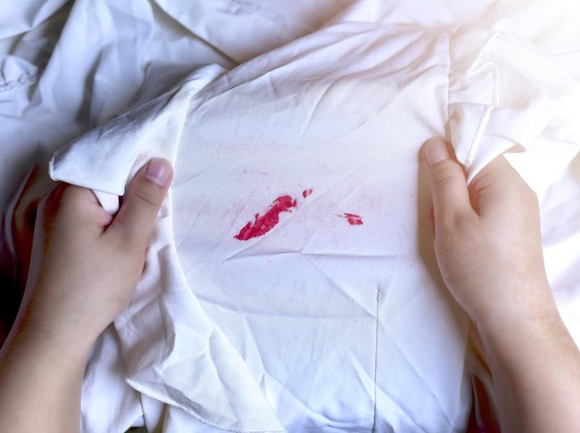 Cara Menghilangkan Noda Lipstik di Baju
