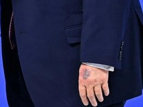 Tangan Lebam Trump Disorot usai Pulang dari Davos, Efek Dosis Tinggi Aspirin?