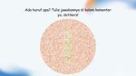 Tes Buta Warna yang Uji Ketajaman Mata, Berhasil Jawab Semua?