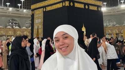 Sebelum Meninggal Dunia, Lula Lahfah Pernah Alami Penyakit Ini