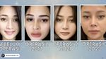 Mutia Ayu Operasi Hidung Keempat Kali, Ini Alasan Utamanya