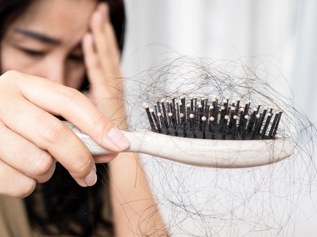 Rambut rontok usai melahirkan
