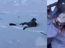 Nekat Mendekat Demi Foto Macan Tutul Salju, Wajah Turis Ini Kena Gigit