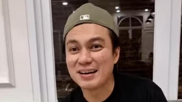Baim Wong Bantah Oplas Hidung di Korea: Cuma Stem Cell