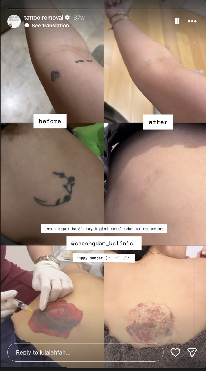 Lula Lahfah Hapus Tato Sebelum Meninggal: Mau Tubuh Kembali Seperti Ciptaan-Nya