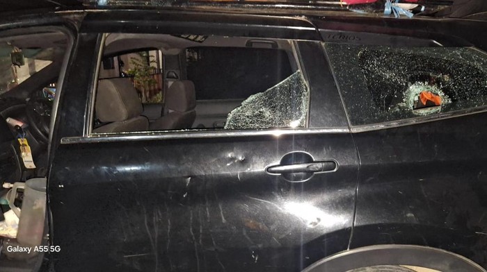 Ibu dan 2 Balita yang Disiram Air Panas 7 Pemuda di Luwu Alami Luka Bakar