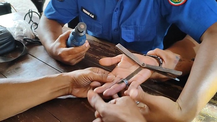 Damkar Pasuruan saat proses melepas cincin dari jari