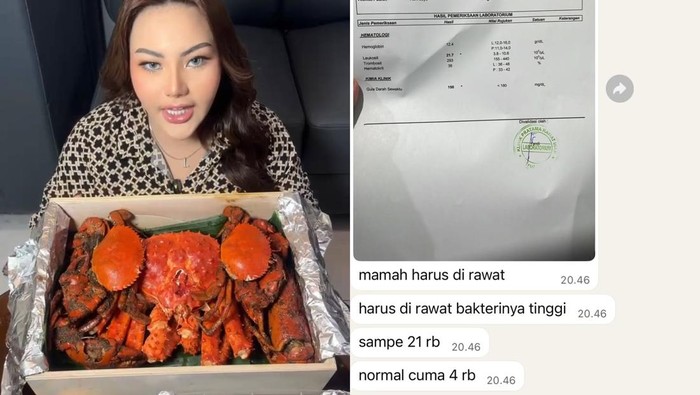 Lisa Mariana Keracunan Kepiting Alaska