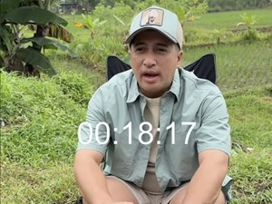 Irfan Hakim Sadar Kena Hujat, Tegaskan Tak Bela Denada atau Ressa