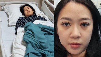 Wanita di Jaksel Kena Stroke di Usia 32 Tahun, Ini Gejala yang Dialami