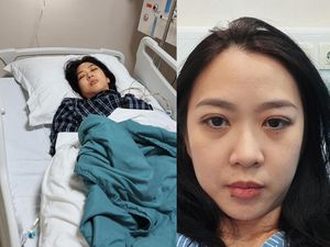 Wanita di Jaksel Kena Stroke di Usia 32 Tahun, Ini Gejala yang Dialami