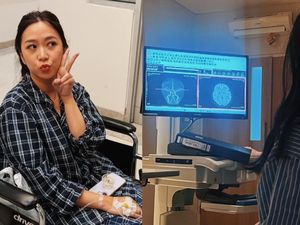 Kisah Wanita di Jaksel Kena Stroke di Usia 32, Awalnya Dikira Cuma Sakit Mata
