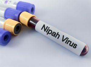 Seberapa Mengancam Virus Nipah di Indonesia? Pakar Ungkap Hal Ini