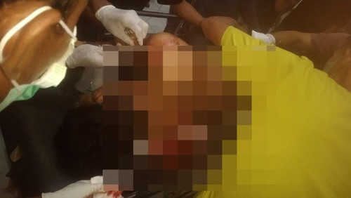 Korban dibacok OTK berkali-kali di Desa Nggembe, Kecamatan Bolo, Kabupaten Bima, NTB, Minggu (1/2/2026) malam. (Dok. Polsek Bolo)