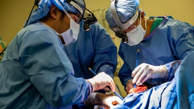 Foto: Momen Dramatis Dokter Operasi Pria Tanpa Paru selama 48 Jam