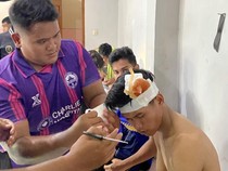 Pemain PSD Demak Diperban Usai Lawan Perseharjo Sukoharjo, Ini Kata Panpel